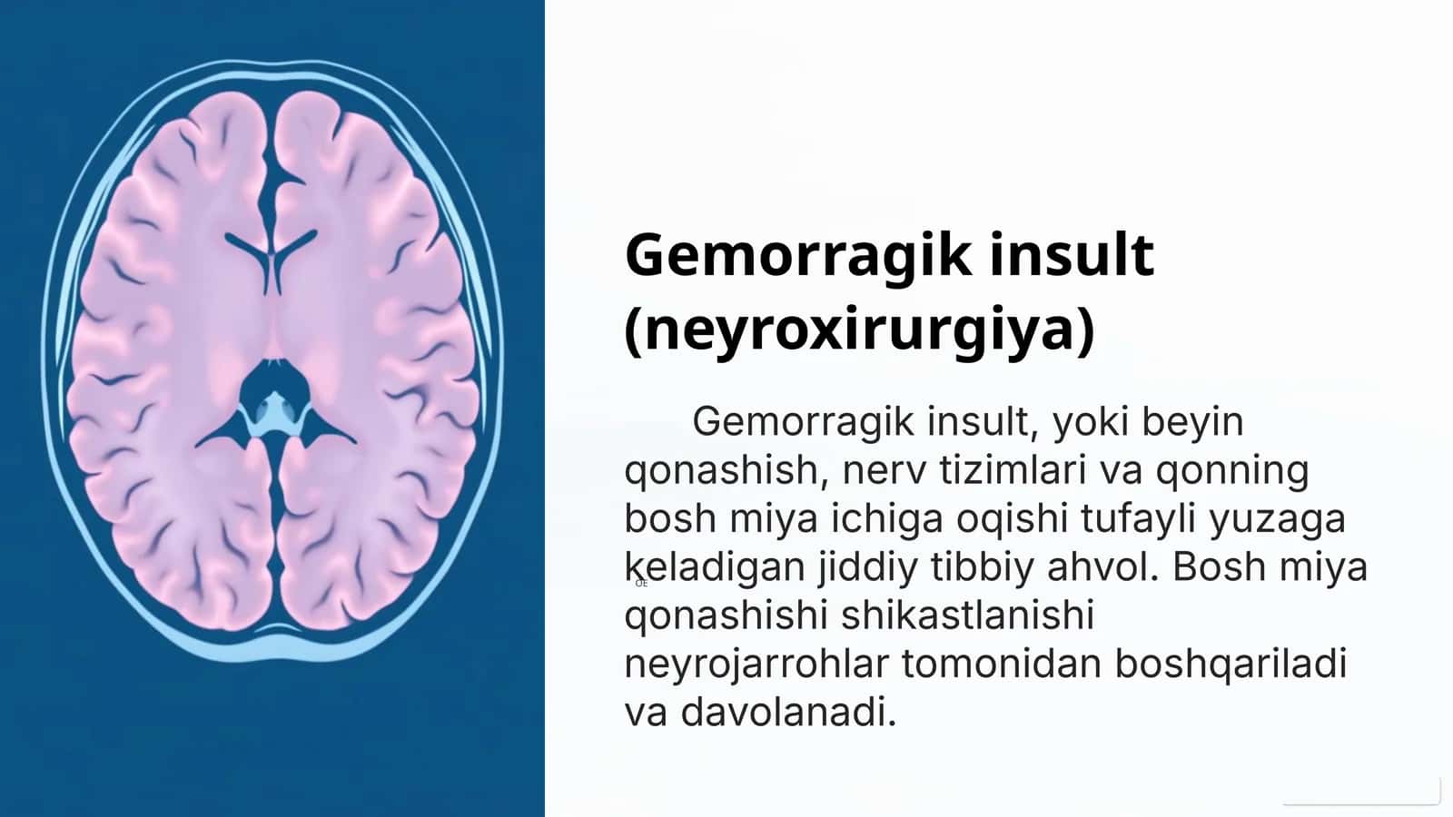 Gemorragik insult (neyroxirurgiya) 1