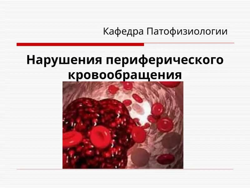 Нарушения периферического кровообращения 1