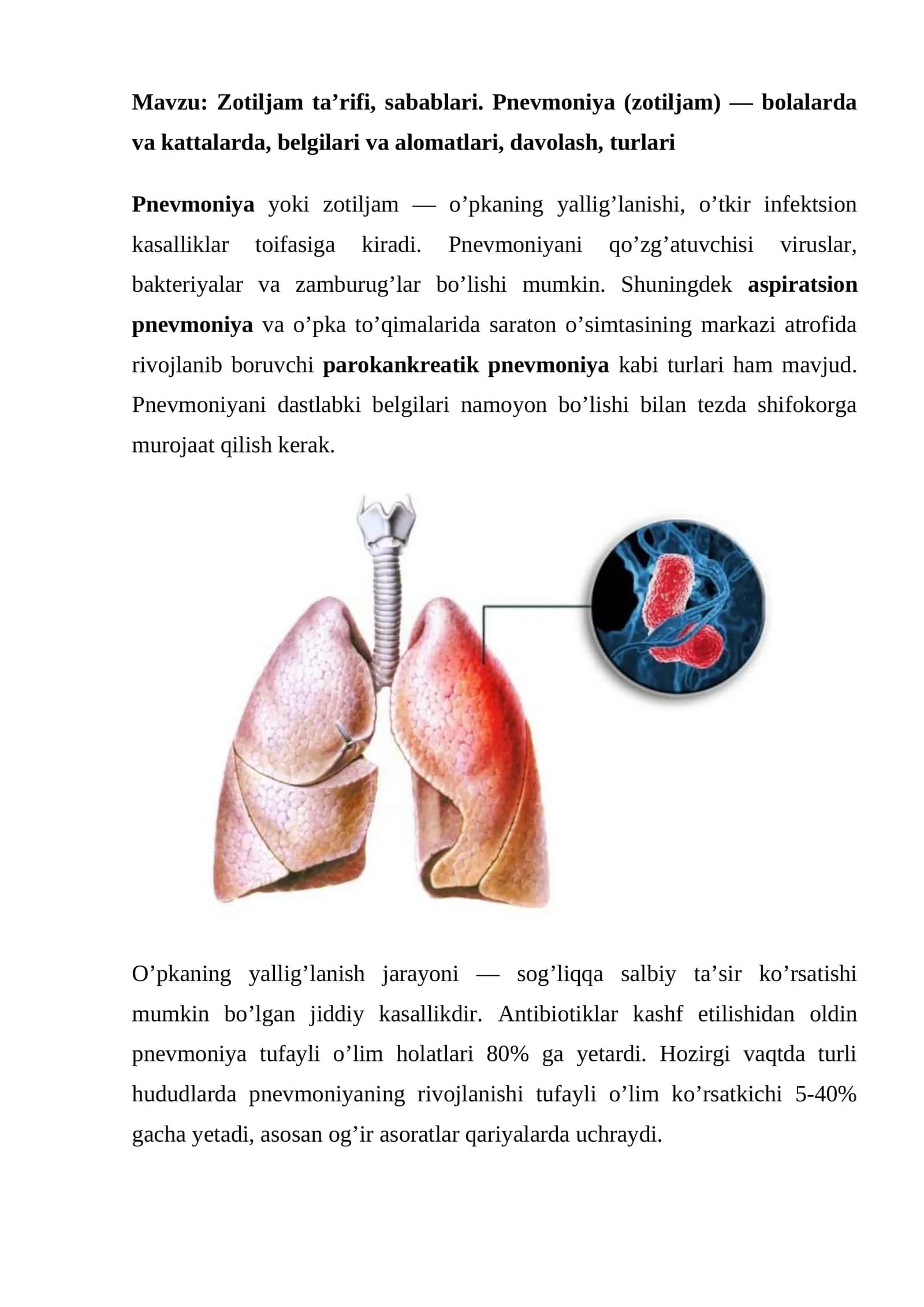 Zotiljam ta’rifi, sabablari. Pnevmoniya (zotiljam) - bolalarda va kattalarda, belgilari va alomatlari, davolash, turlari 1