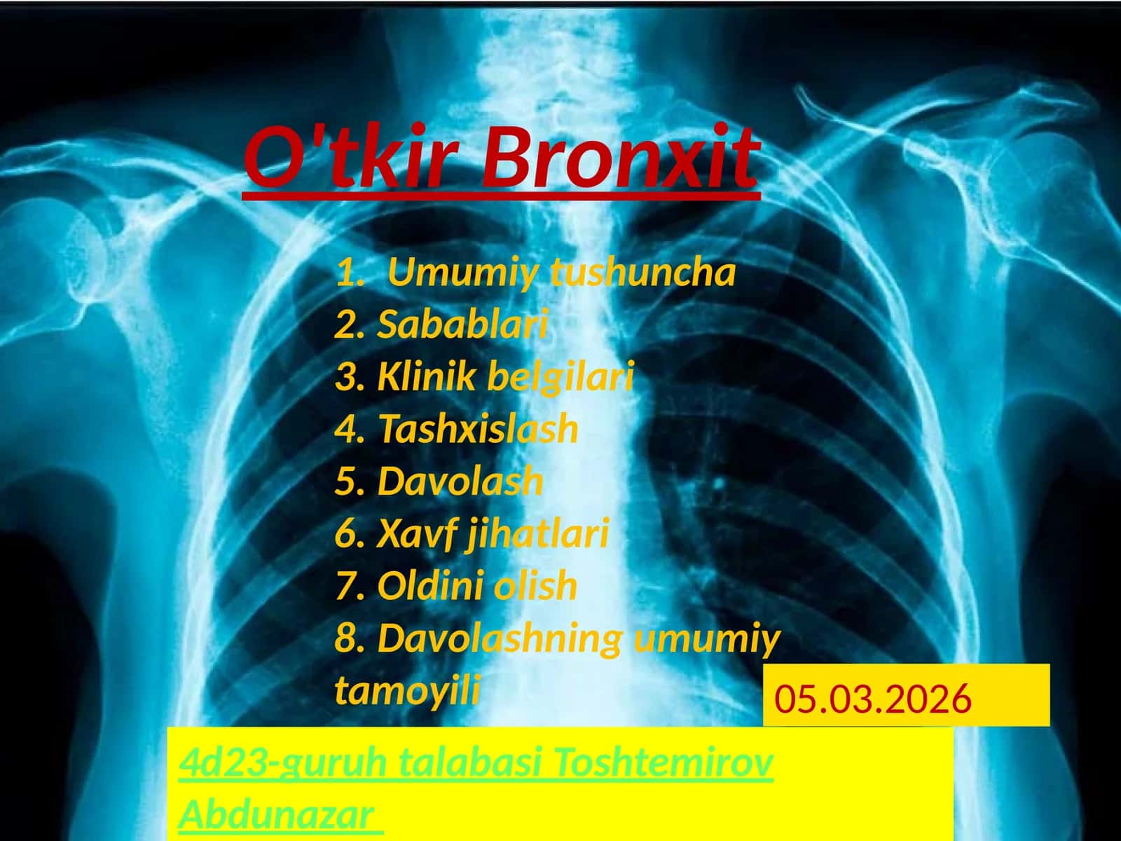 Oʻtkir Bronxit 1