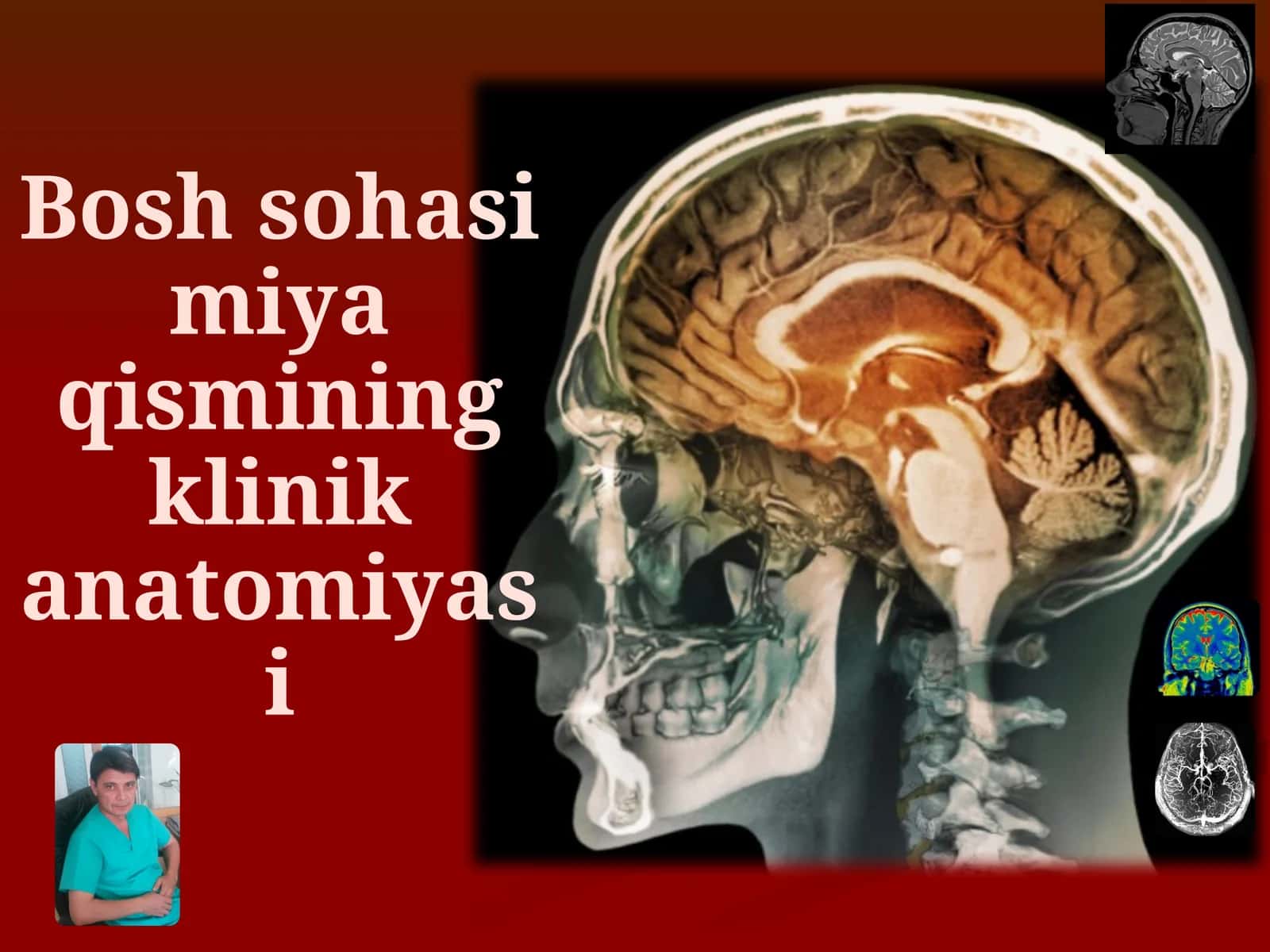Boshsohasimiyaqisminingklinikanatomiyasi 1