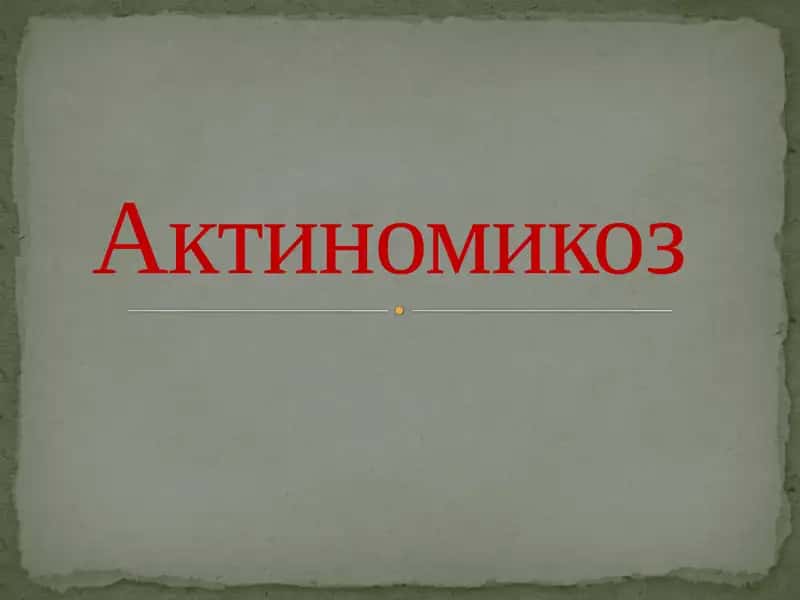 Актиномикоз 1