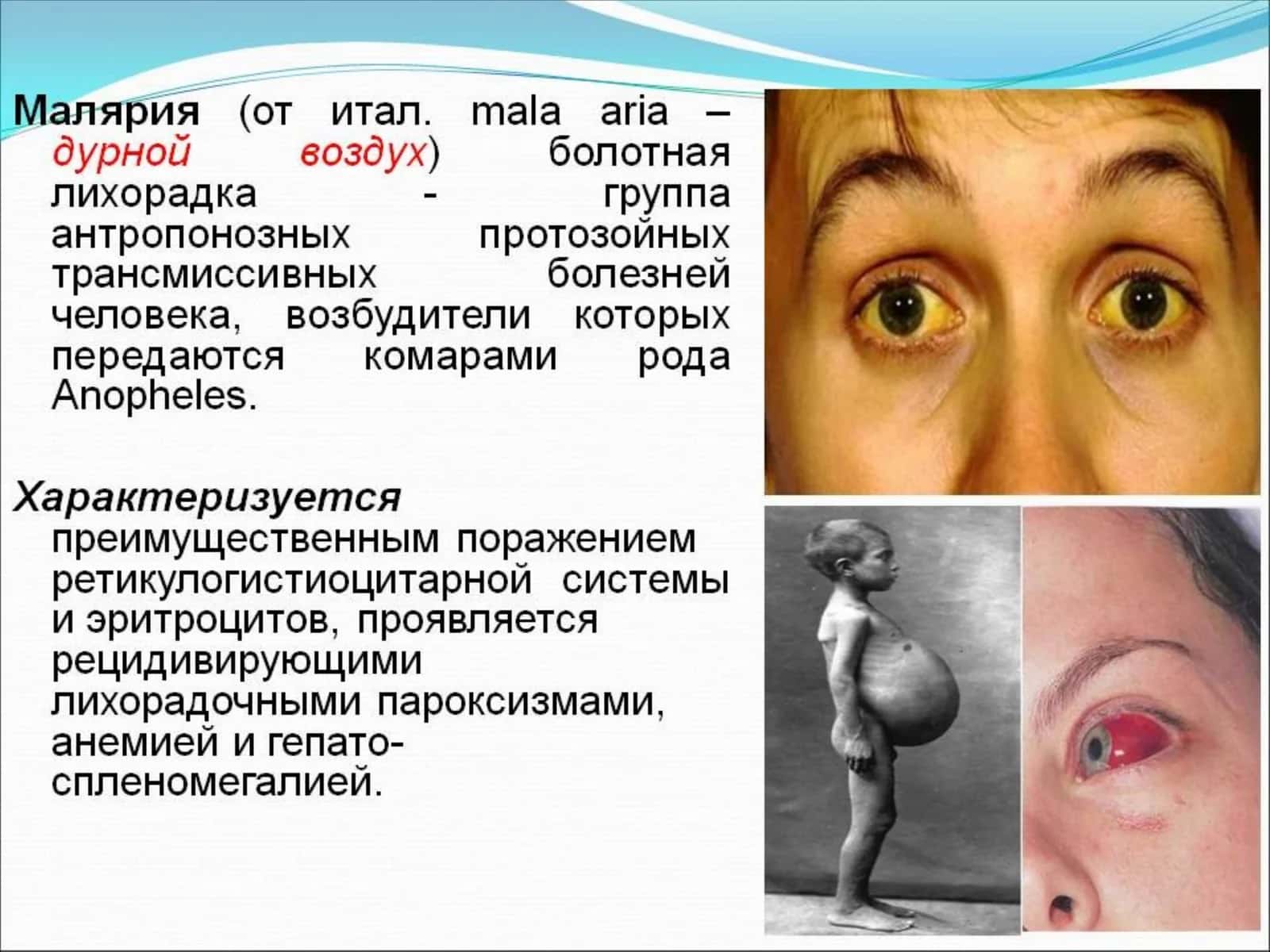 malyariya ppt 1