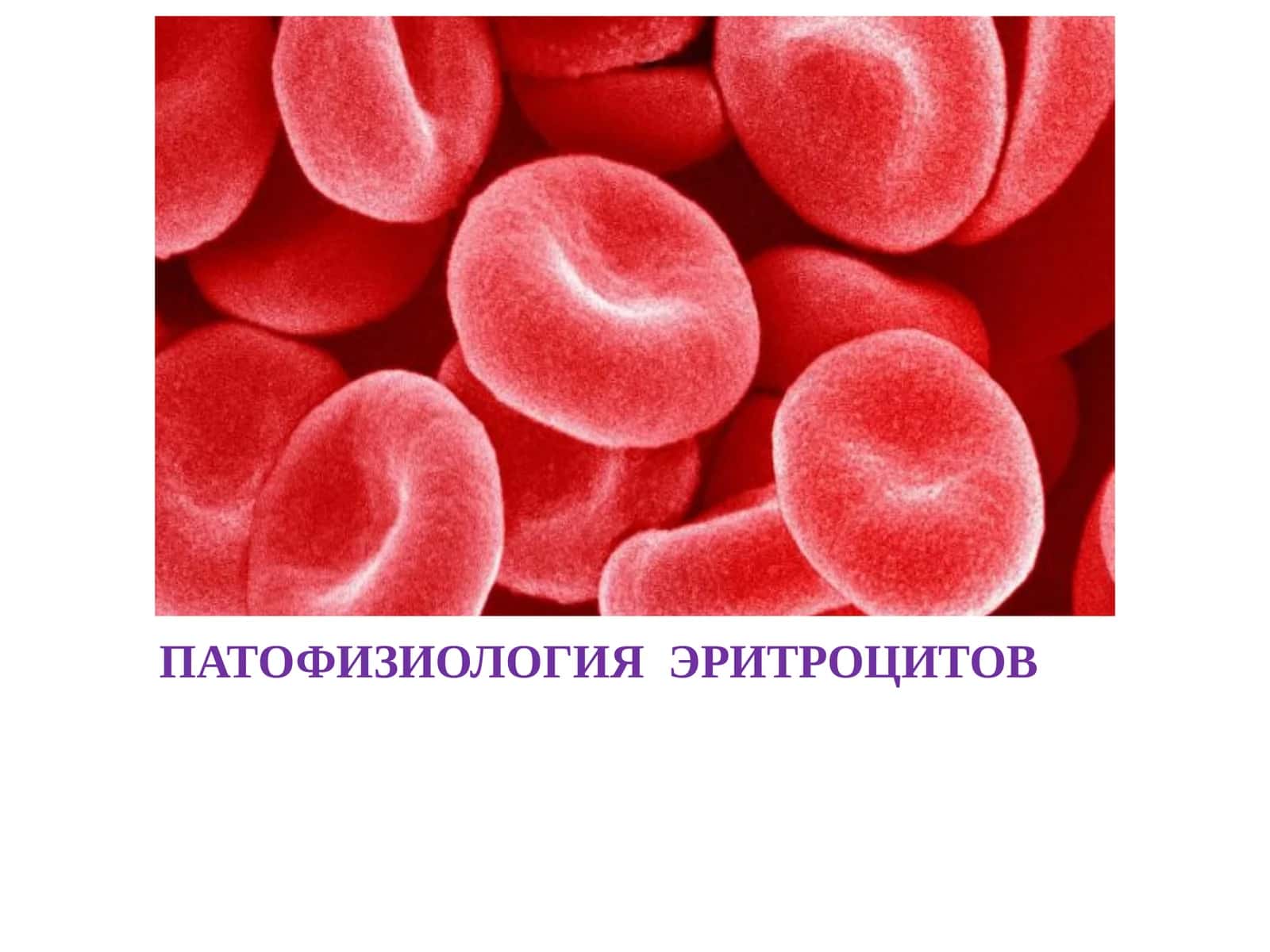 ПАТОФИЗИОЛОГИЯ  ЭРИТРОЦИТОВ 1