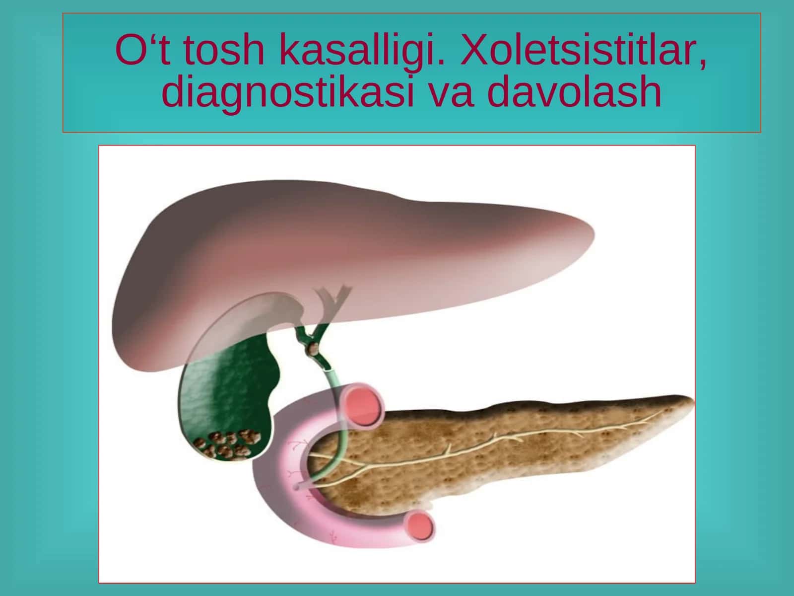 O‘t tosh kasalligi. Xoletsistitlar, diagnostikasi va davolash 1
