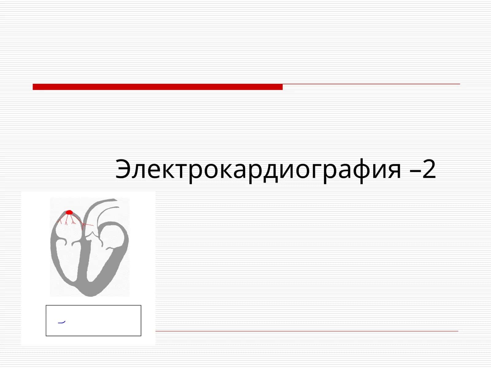 Электрокардиография –2 1