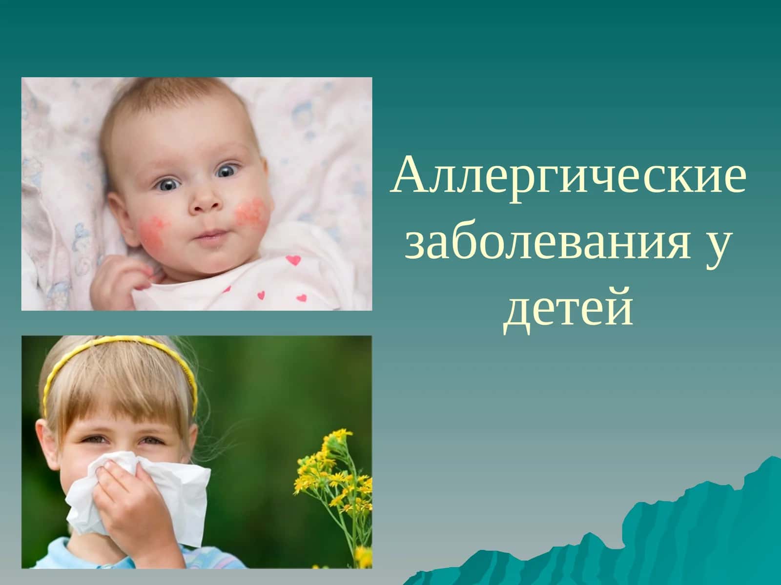 Аллергические заболевания у детей 1