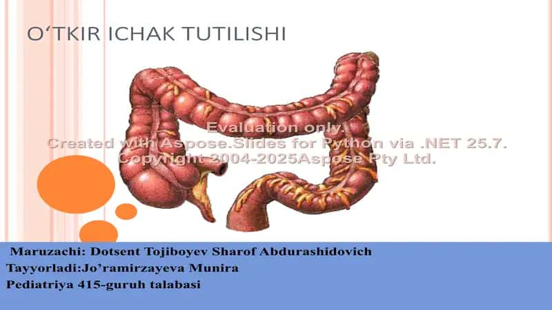Ichak tutilishi 1
