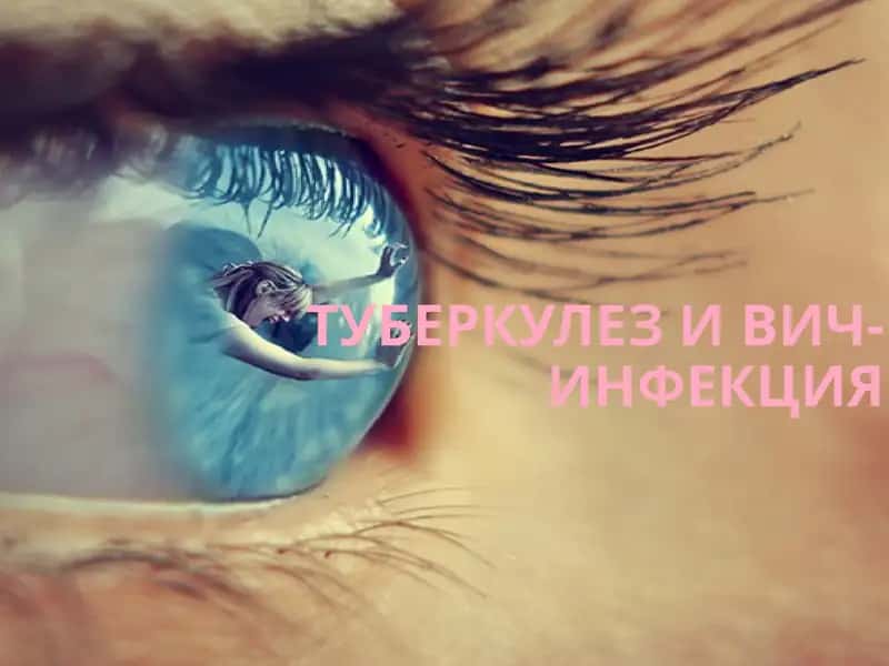 Туберкулез и ВИЧ-инфекция 1
