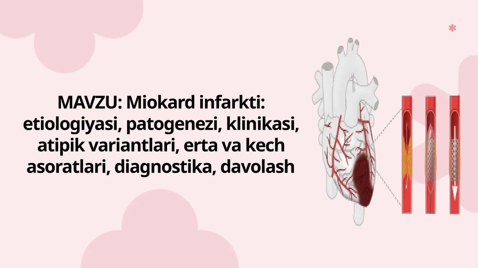 Miokard infarkti 1