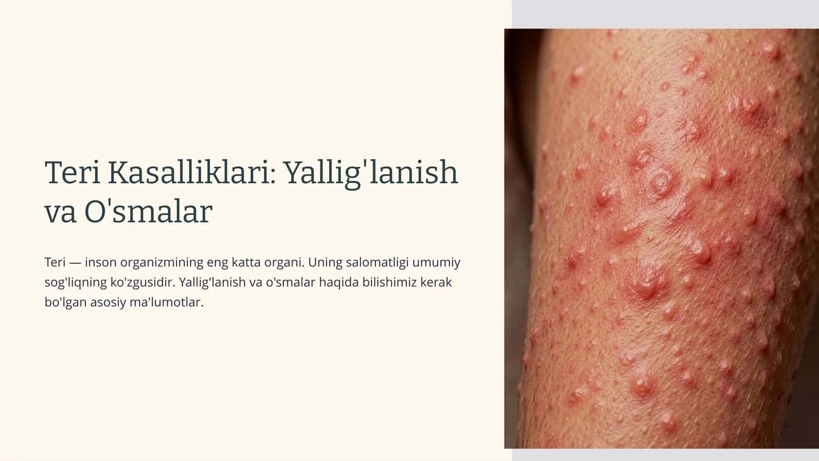 Teri Kasalliklari: Yallig'lanish va O'smalar 1