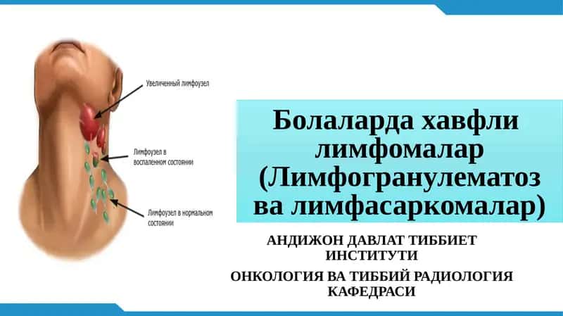 Болаларда хавфлилимфомалар(Лимфогранулематозвалимфасаркомалар) 1