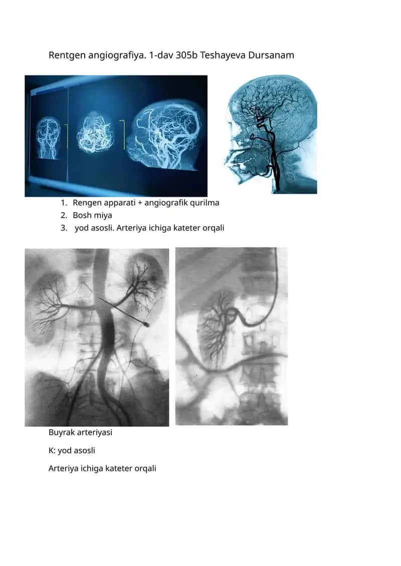 Rentgen angiografiya 1