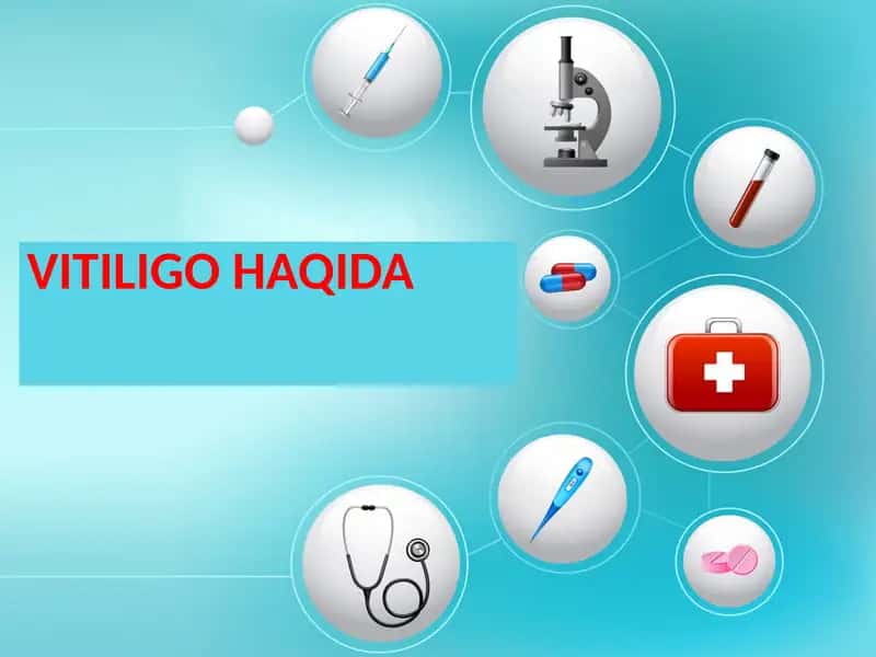 VITILIGO HAQIDA 1