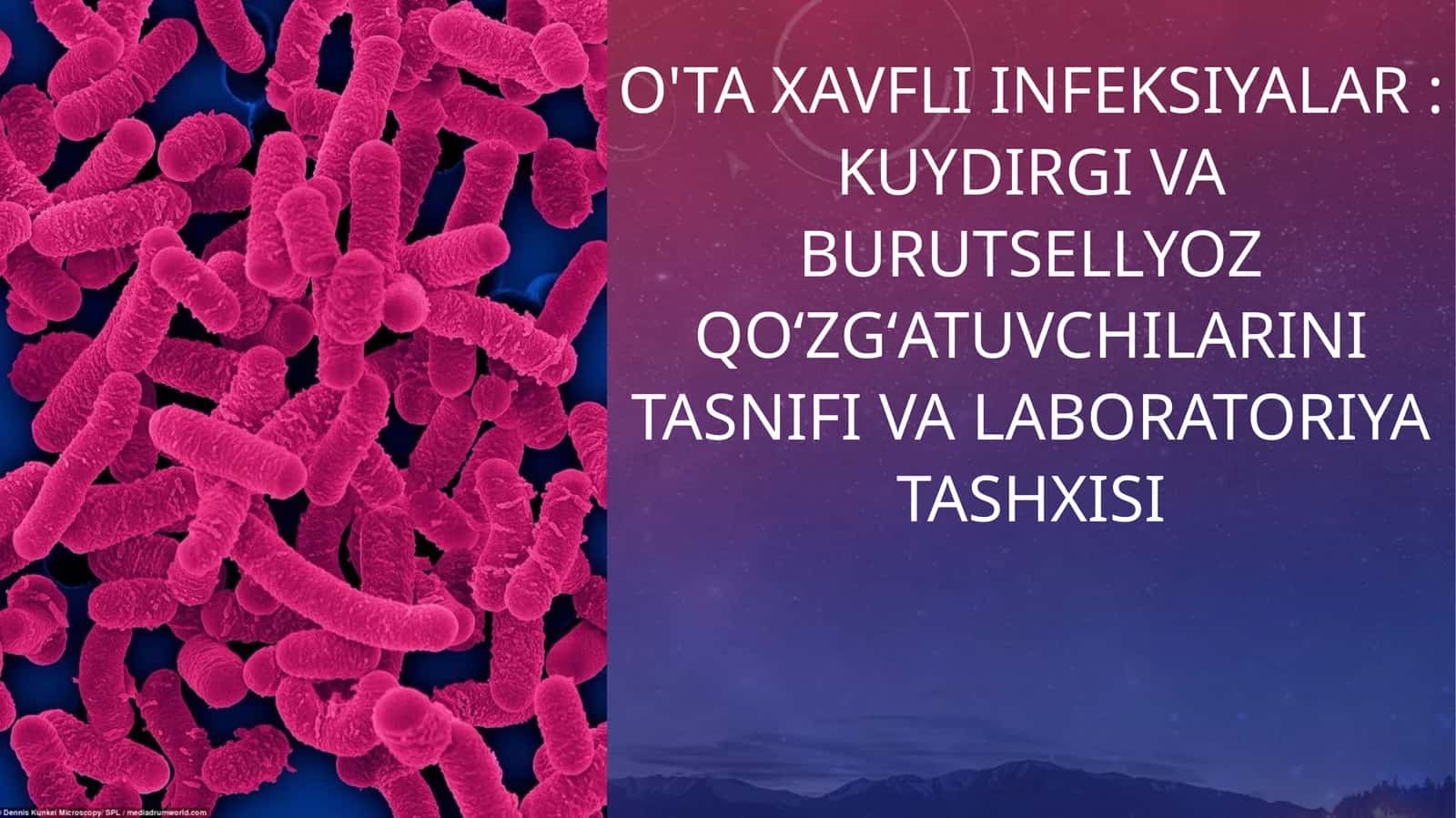O'ta xavfli infeksiyalar  Kuydirgi va burutsellyoz qoʻzgʻatuvchilarini tasnifi va laboratoriya tashxisi 1