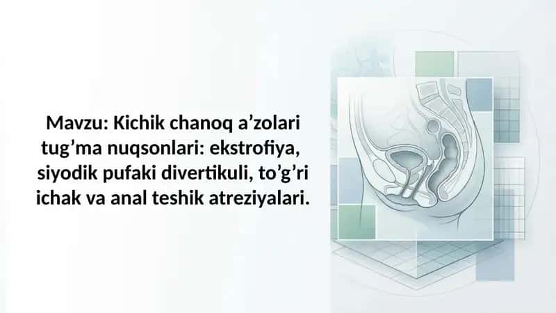 Kichik chanoq a'zolari tug'ma nuqsonlari ekstrofiya, siyodik pufaki divertikuli, to'g'ri ichak 1