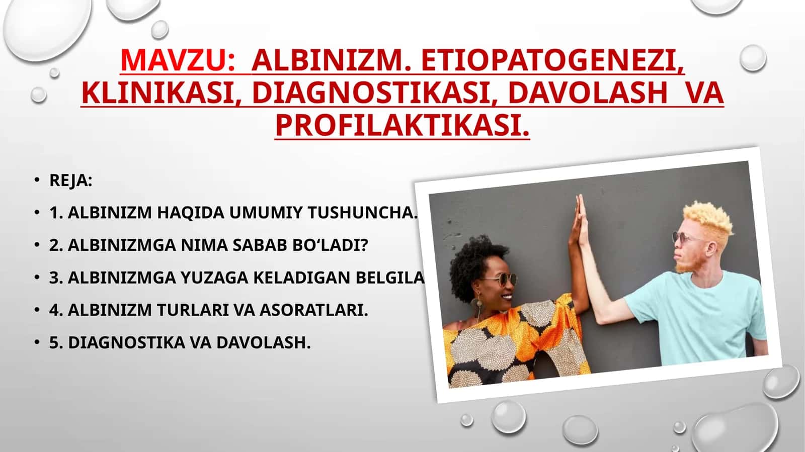 Albinizm. Etiopatogenezi, klinikasi, diagnostikasi, davolash va profilaktikasi 1