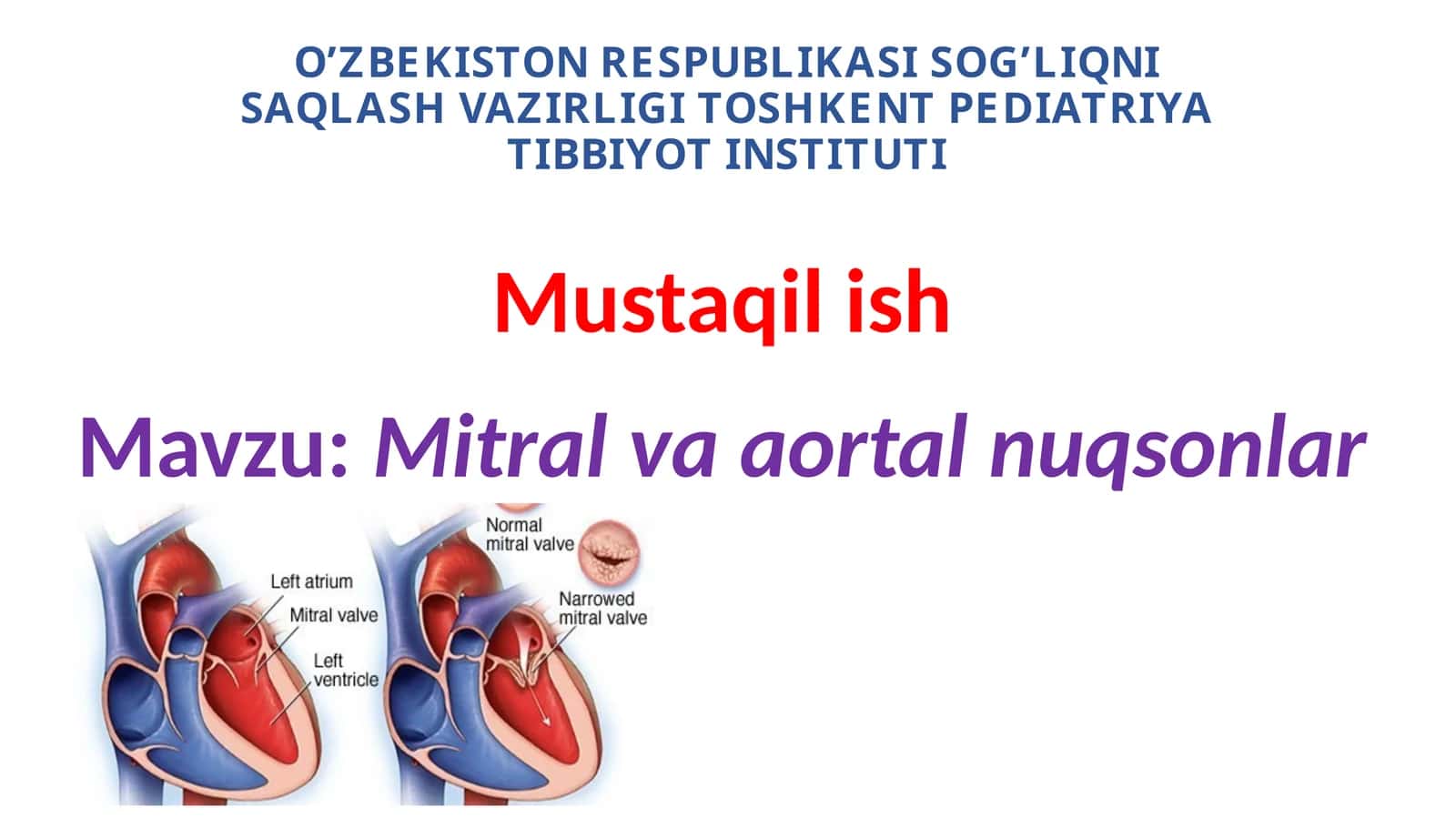 Ortirilgan yurak nuqsonlari. Mitral va aortal nuqsonlar 1