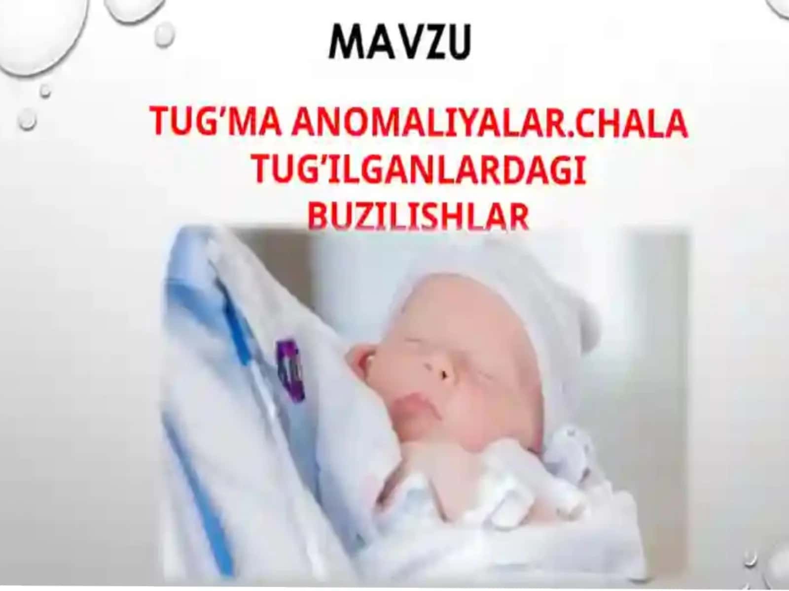 tugʻma anomaliyalar chala tugʻ ilganlardagi buzilishlar 1