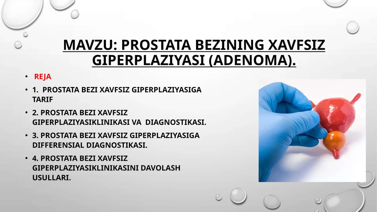 Prostatabezining xavfsiz giperplaziyasi (adenoma) 1
