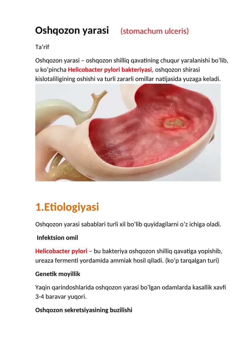 Oshqozon yarasi (stomachum ulceris) 1