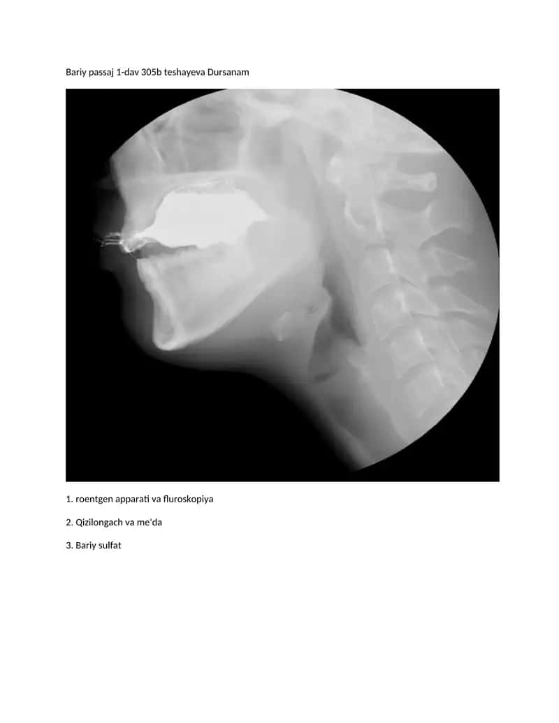 Roentgen apparati va fluroskopiya 1
