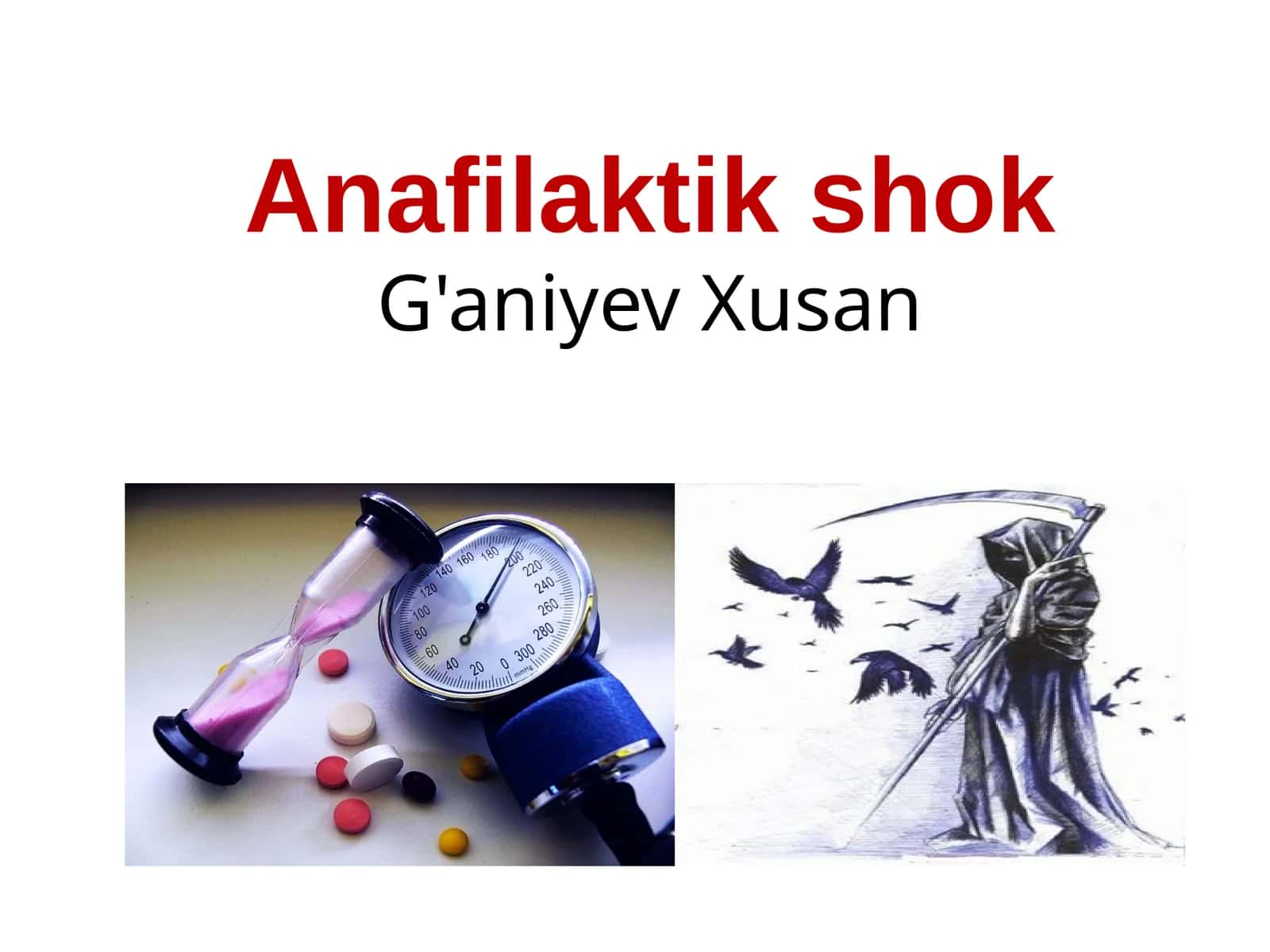 Anafilaktik shok 1