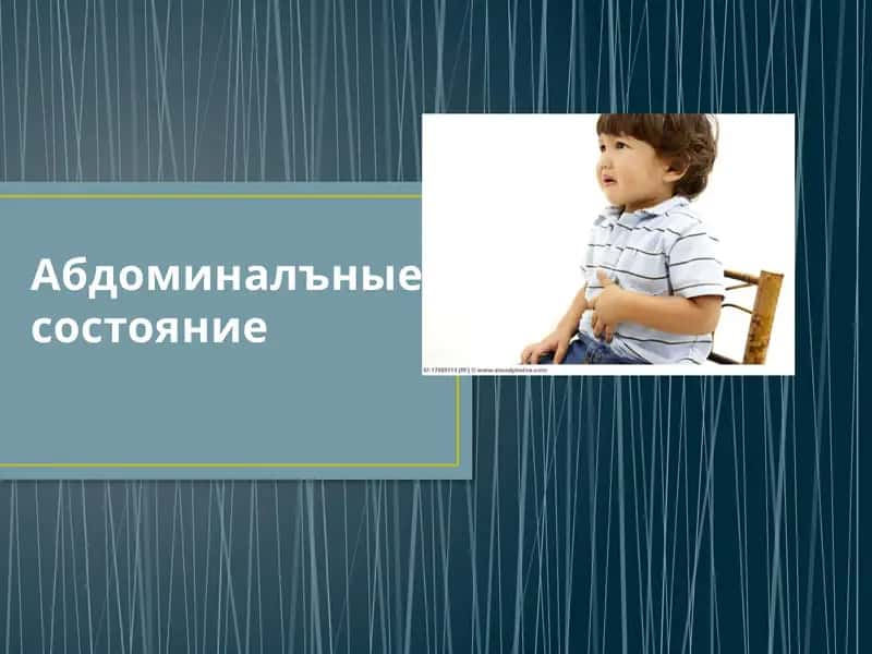 Болевой абдоминальный синдром 1