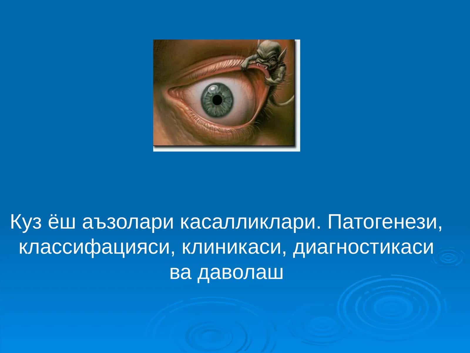Кузёш аъзолари касалликлари. Патогенези, классифацияси, клиникаси, диагностикаси ва даволаш 1