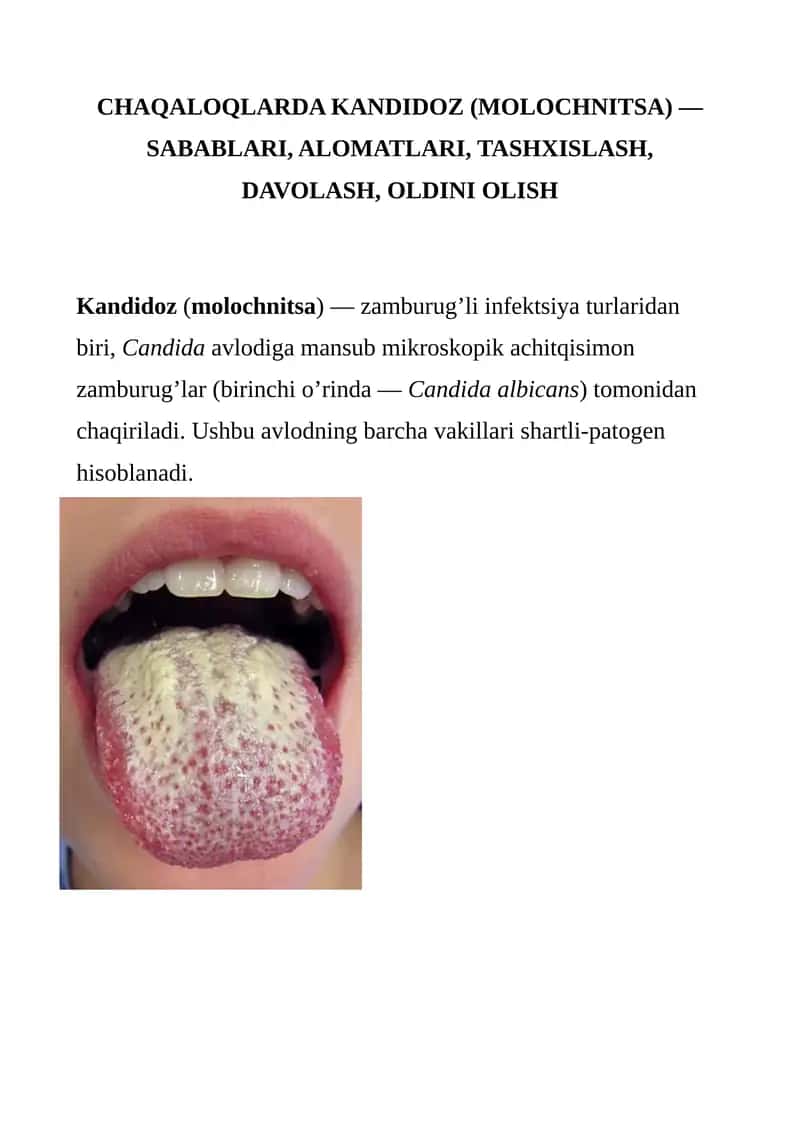 CHAQALOQLARDA KANDIDOZ (MOLOCHNITSA) 1