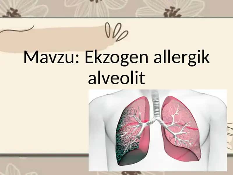 Ekzogen allergik alveolit 1