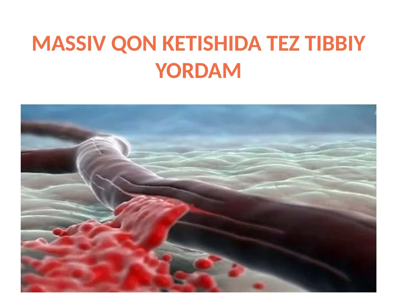 MASSIV QON KETISHIDA TEZ TIBBIY YORDAM 1