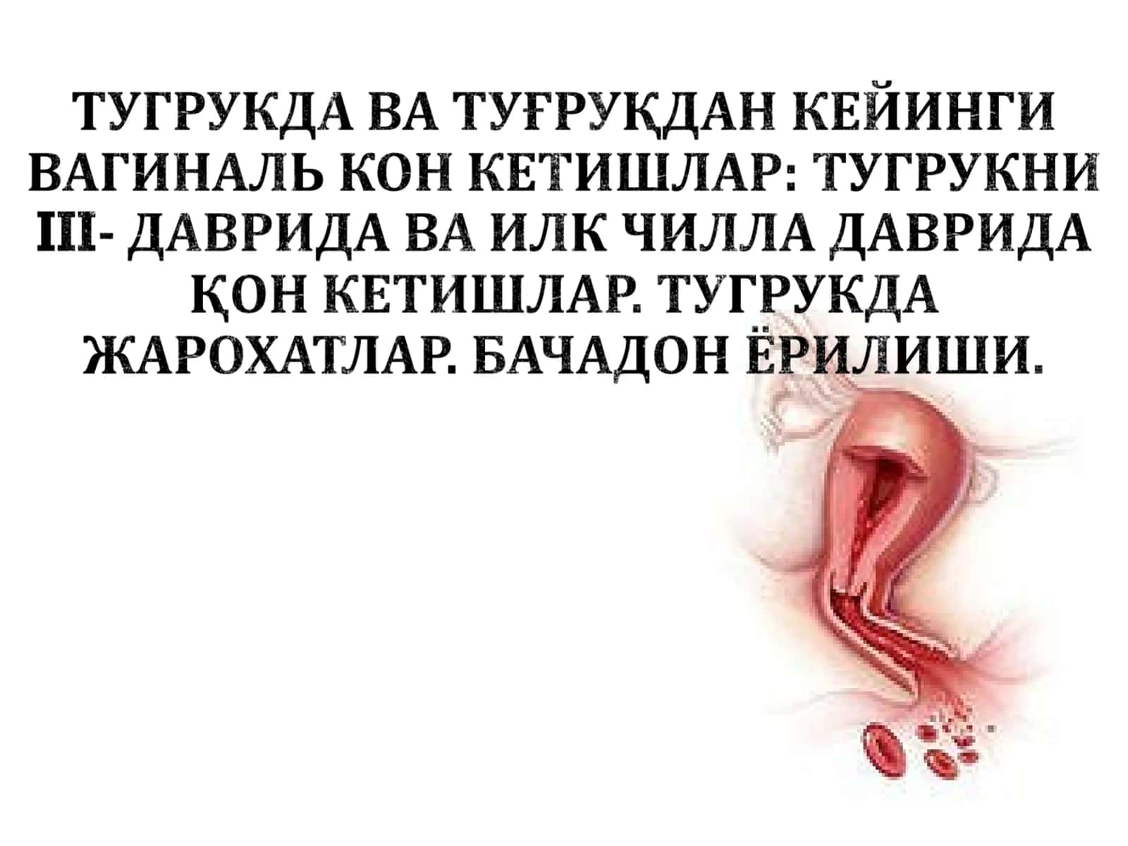 Туғруқдан кейинги қон кетиши 1