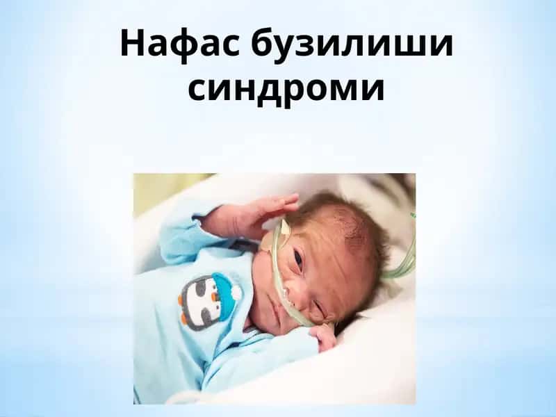 Нафас бузилиши синдроми 1