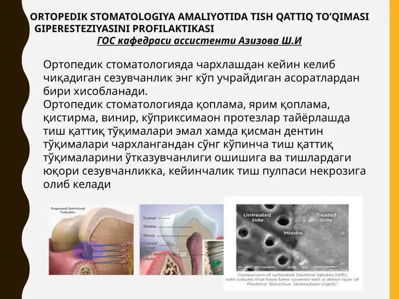 Ортопедик стоматологияда тиш қаттиқ тўқимаси 1