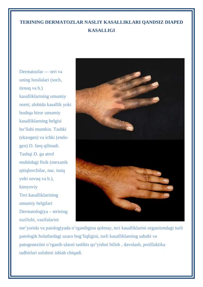 TERINING DERMATOZLAR NASLIY KASALLIKLARI QANDSIZ DIAPED KASALLIGI 1