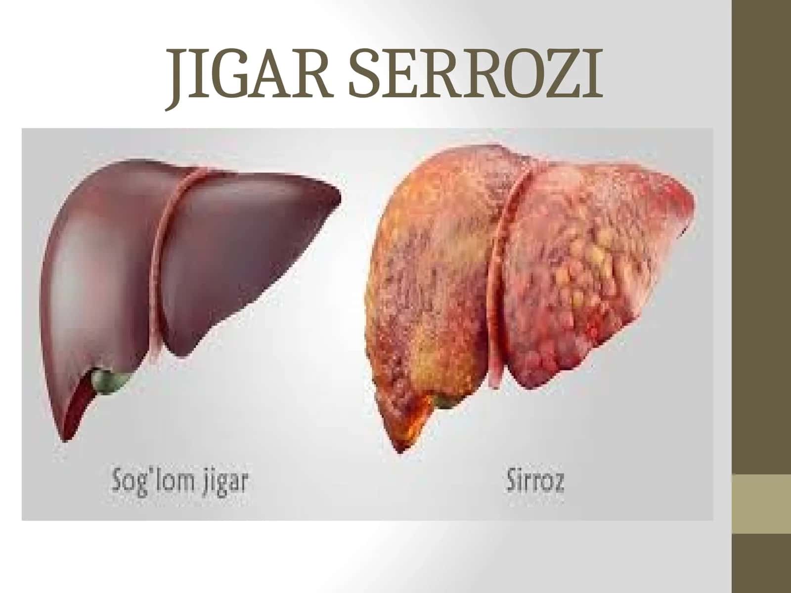 JIGAR SERROZI 1