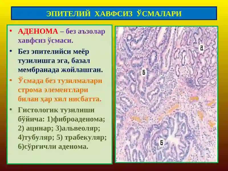 ЭПИТЕЛИЙ ХАВФСИЗЎСМАЛАРИ 2