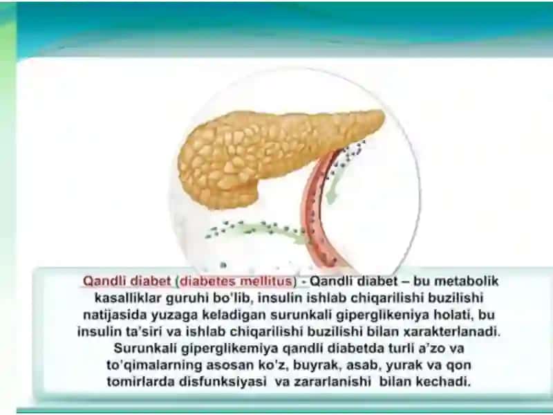 Qandli diabet 1 tip 2