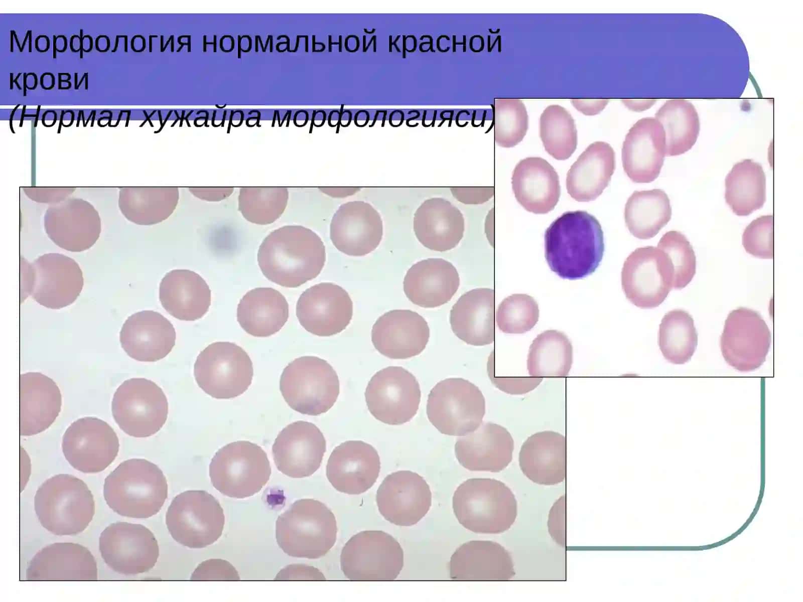 Анемии хронических заболеваний( Сурункали касалликлар Камконликлари)КАФ. КЛД 2