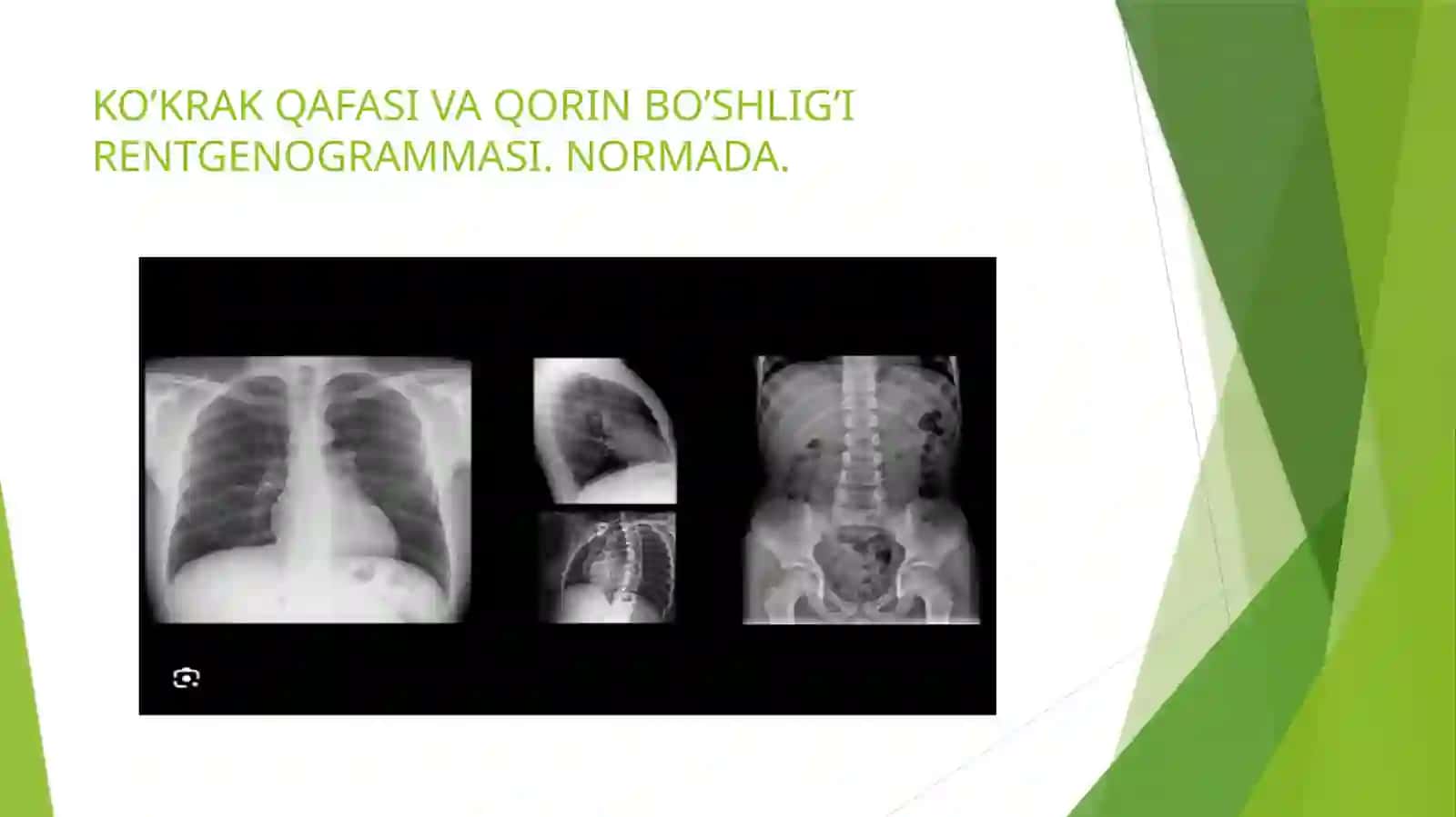 NAFAS A’ZOLARINING RENTGENANATOMIYASI 2