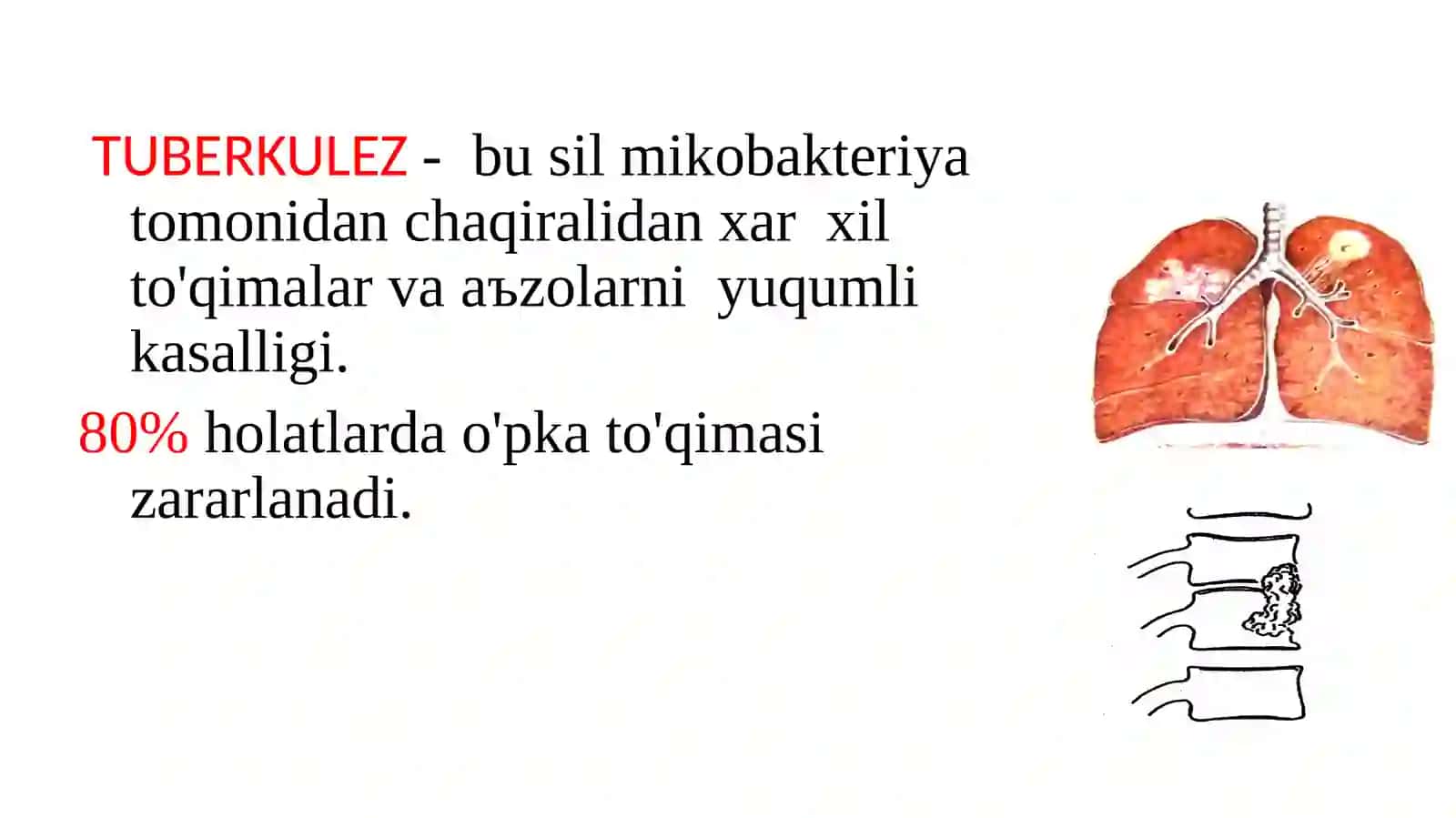 Tuberkulezo'zinima?Tuberkulez(sil-so'nish) 2