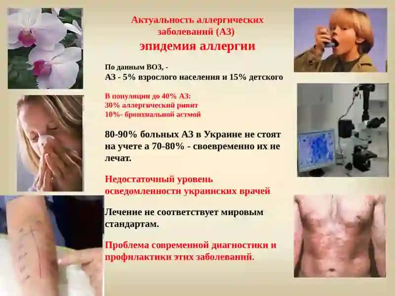 Атопычны хвороби та ынші алергычны (не атопычны)  захворювання 2