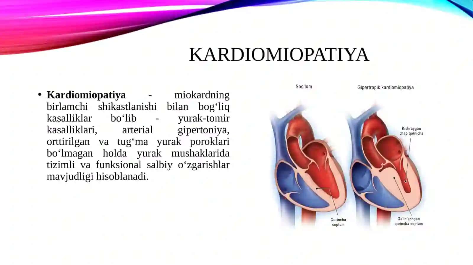 Kardiomiopatiya 2