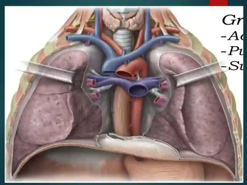 MEDIASTENIT 2