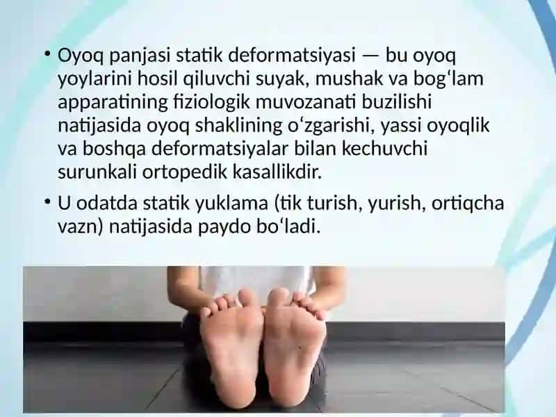 Oyoq panjasi statik deformatsiyasi 2