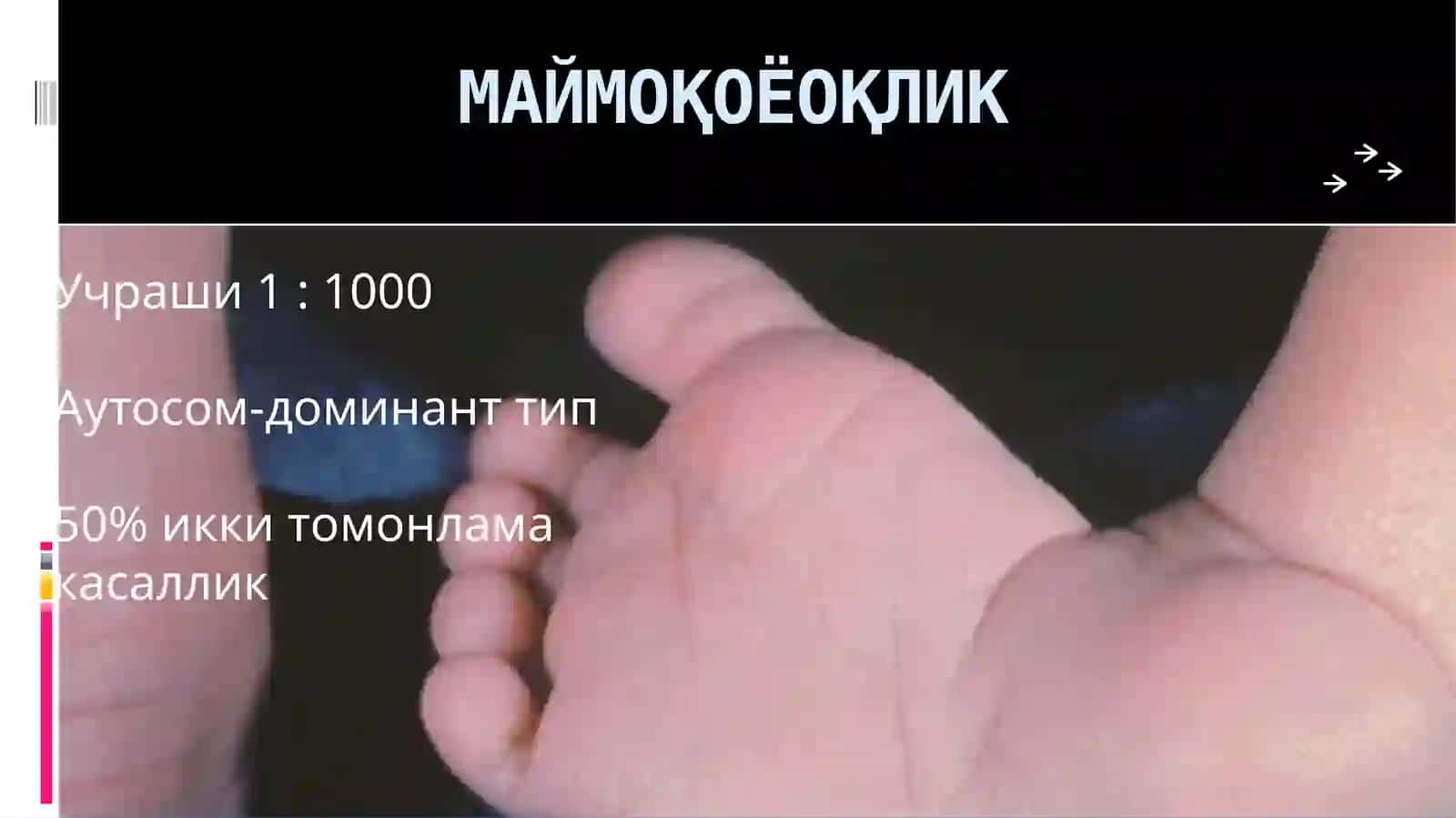 МАЙМОҚОЁҚЛИК 2