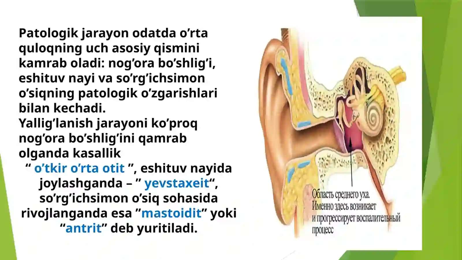 Oʻrtaquloq kasalliklari:oʻtkir oʻrta otit,surunkali otit va asoratlari. Klinik belgilari va diagnostikasi 2