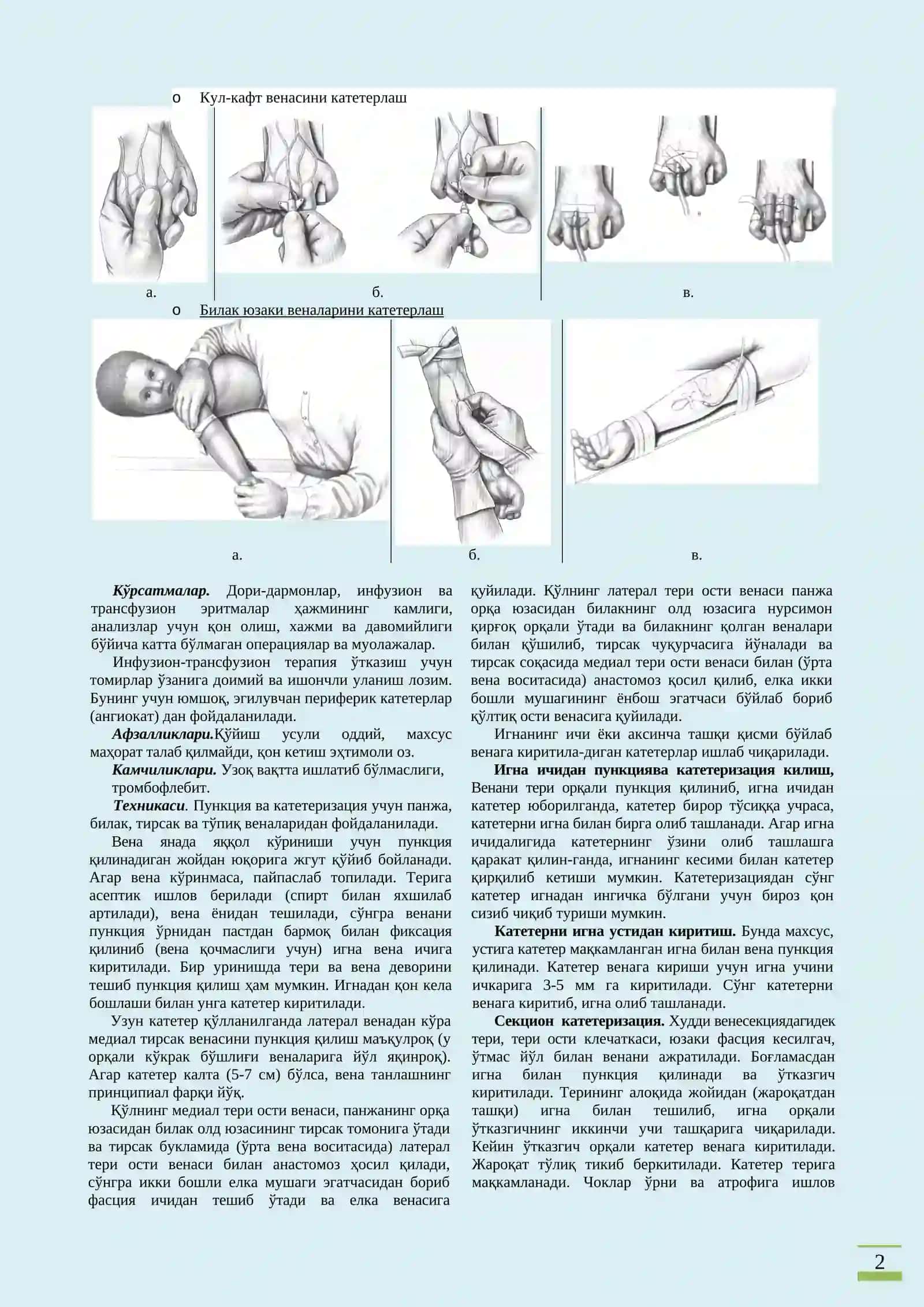Периферик веналар пункцияси ва катетеризацияси 2