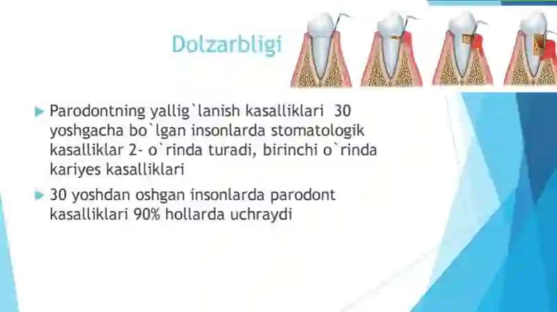 Paradont kasalliklarini ortopedik va jarrohlik davolash usullari 2